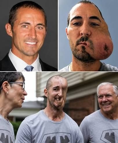 Tim McGrath's journey as a cancer survivor and his facial reconstruction